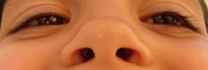 nose